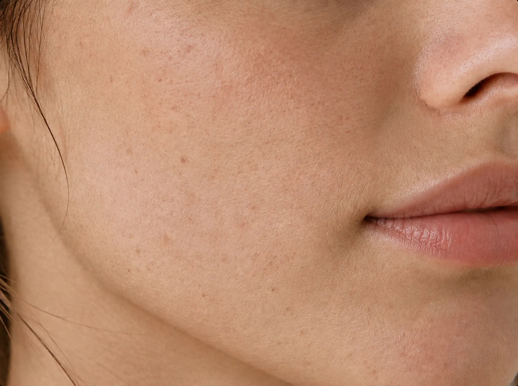Glass Skin Facial, before