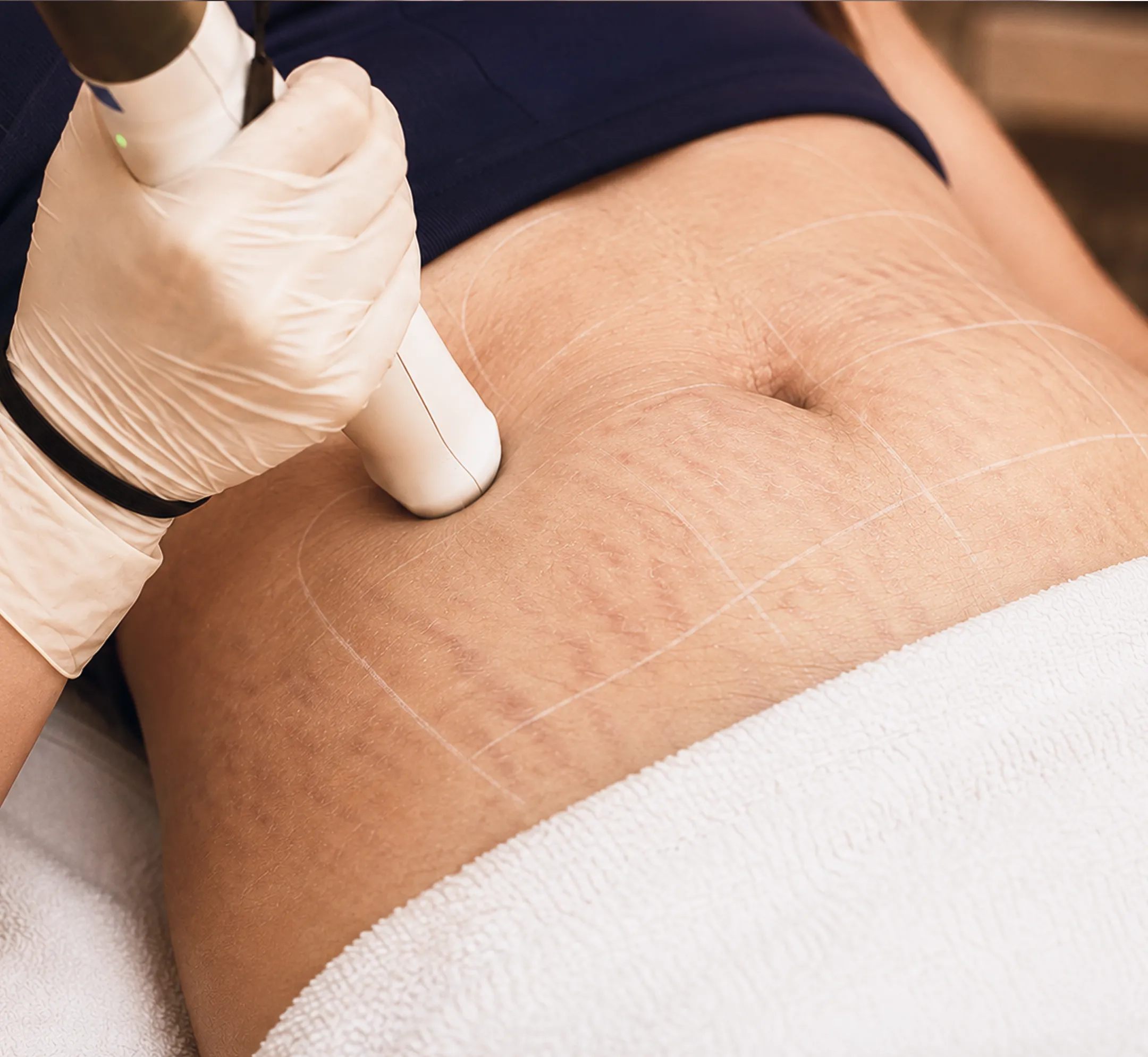 The Journey to Advanced Contouring