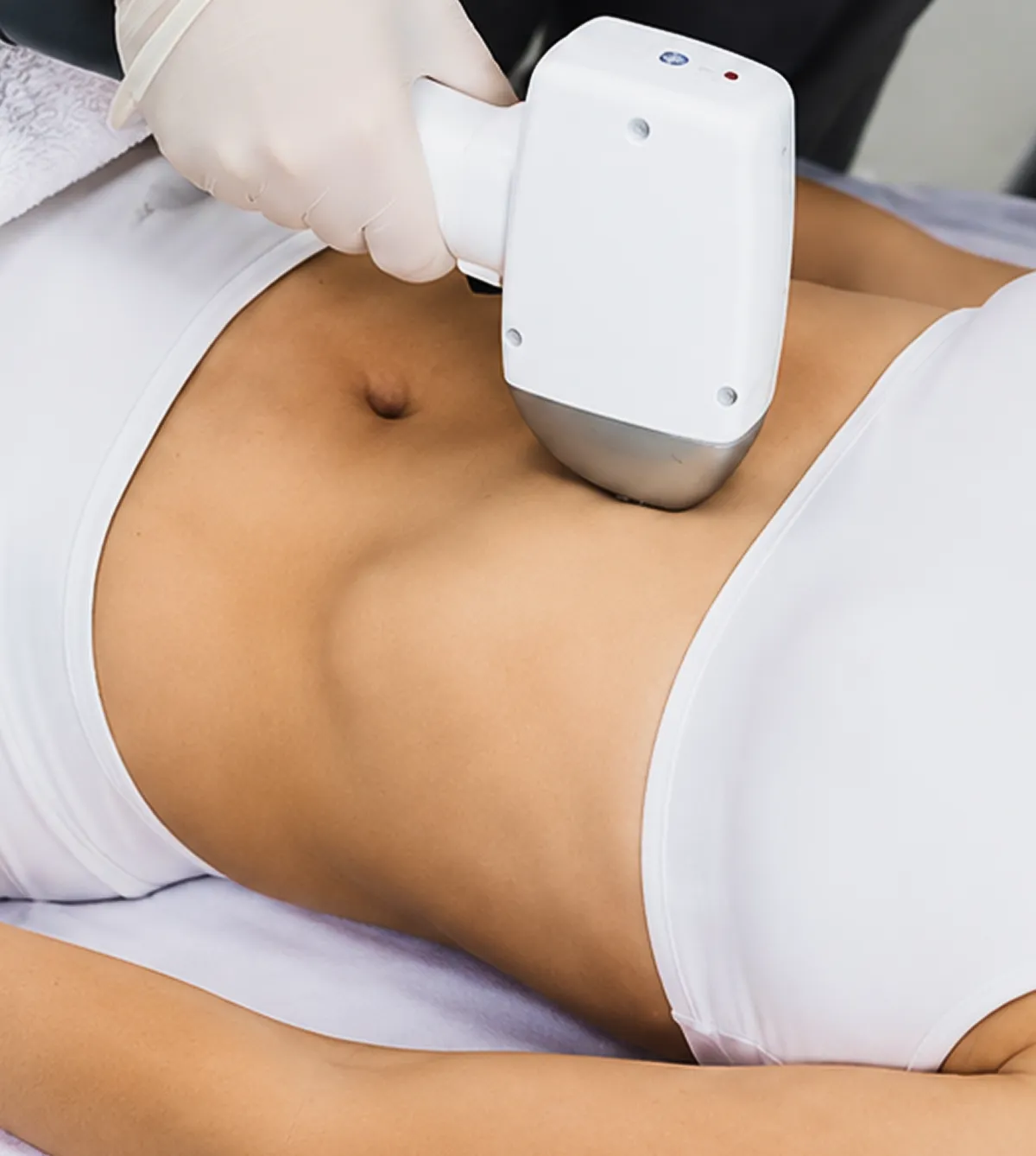 Laser Resurfacing