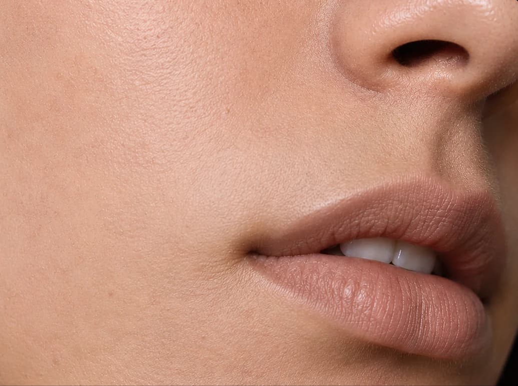 Hydrafacial, after