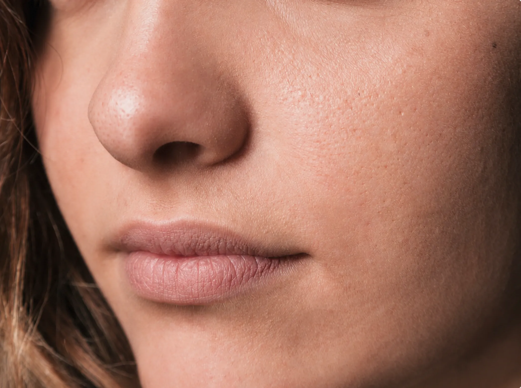 Botox, after